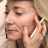 Radiesse – LNDA Skin Clinic
