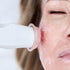 LNDA Glow Facial – LNDA Skin Clinic