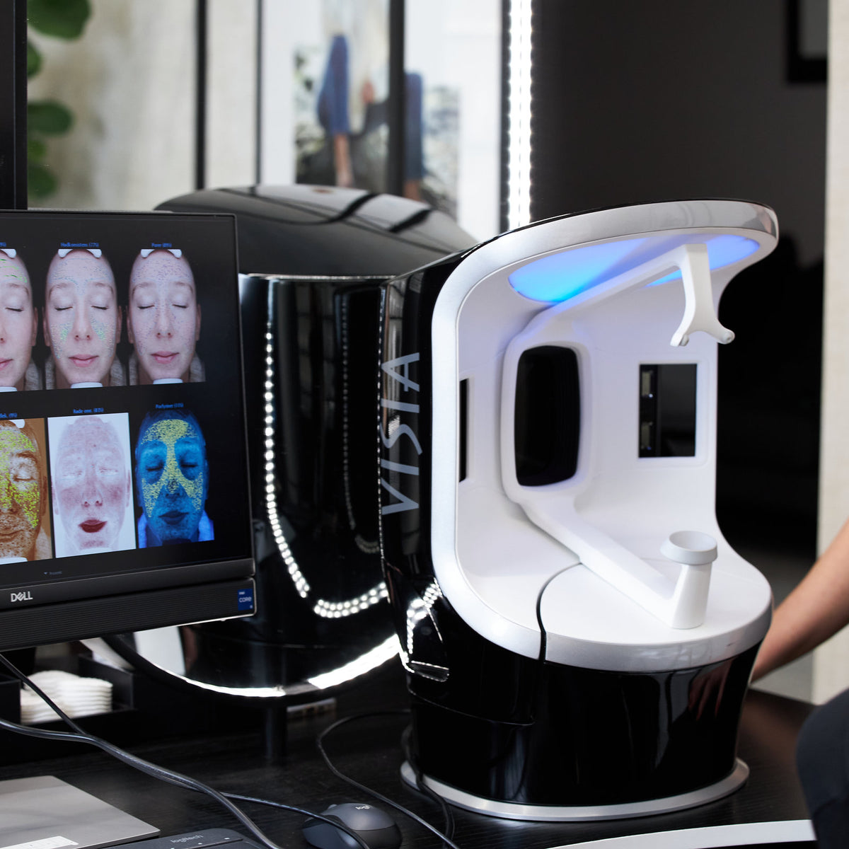 VISIA hudskann – LNDA Skin Clinic